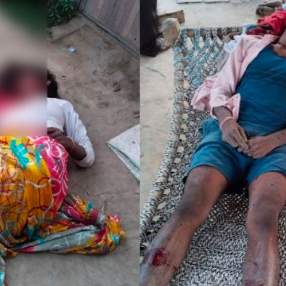 मां और भाई को सरियों से सिर कूचकर मार डाला:मुरादाबाद में पुलिस ने युवती को हिरासत में लिया; पुलिस बोली- मानसिक रूप से कमजोर है युवती