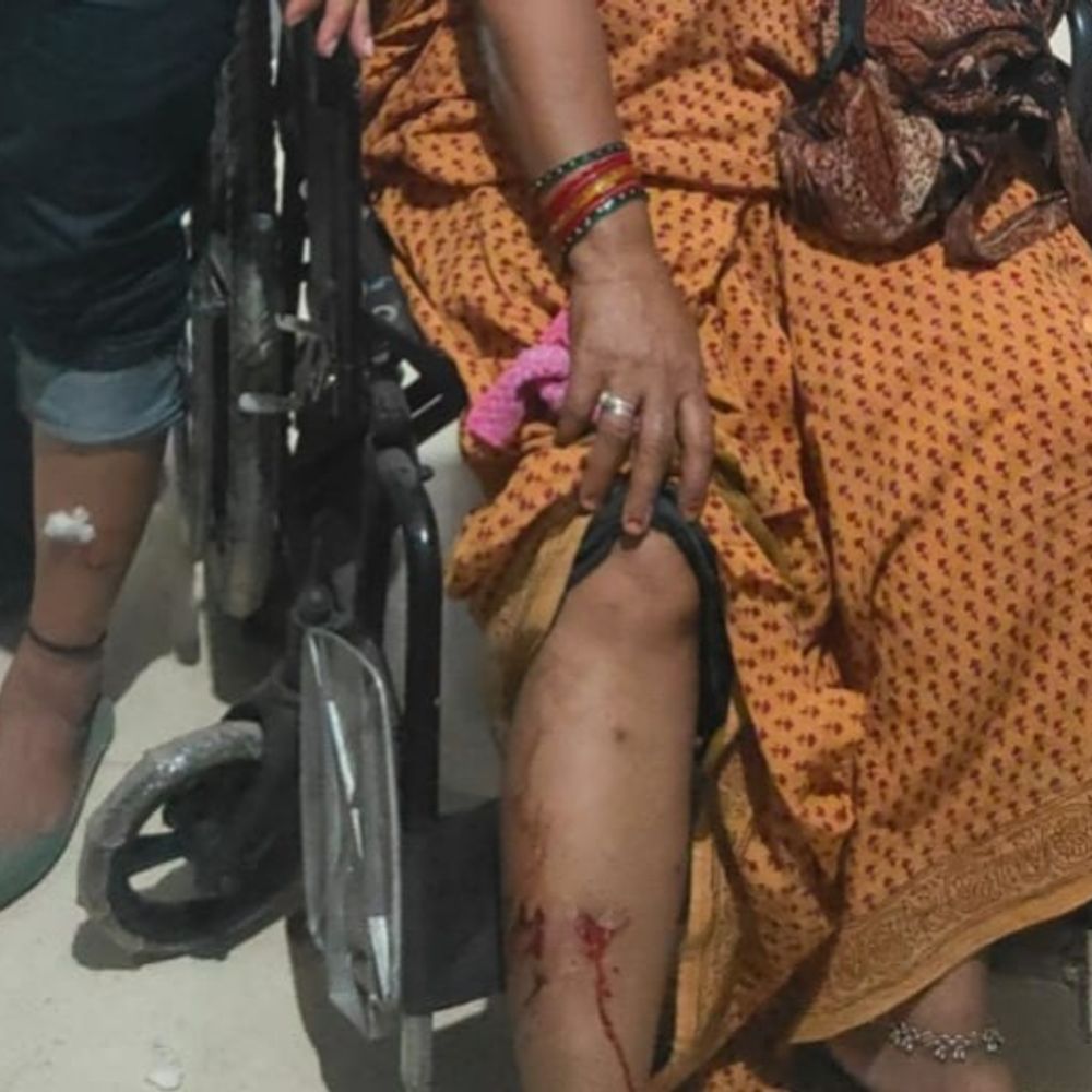 स्ट्रीट डॉग ने 3 घंटे में 40 लोगों को काटा:सतना जिला अस्पताल में एंटी-रेबीज इंजेक्शन लगाने पहुंची भीड़