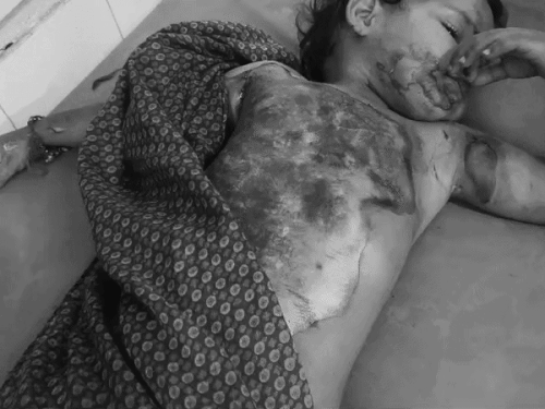 लुधियाना में 3 साल की मासूम को लगी आग:  मां काम पर गई थी,घर में अकेले थे बच्चे; 60% झुलसी सिविल अस्पताल में भर्ती – Ludhiana News