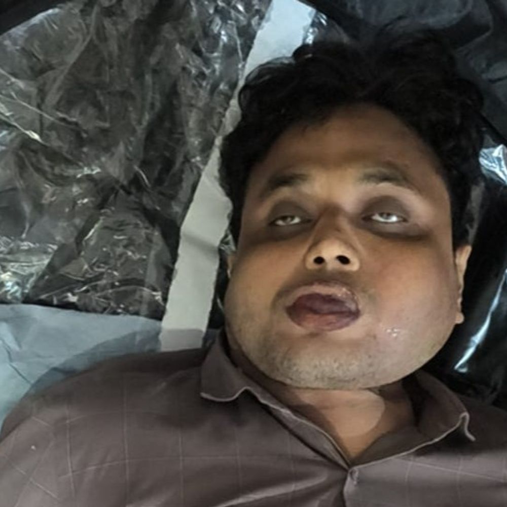 लखनऊ में होटल के कमरे में युवक की संदिग्ध मौत:मुंह से निकल रहा था झाग; दूसरे राज्य से आया था: शव को पोस्टमार्टम के लिए भेजा