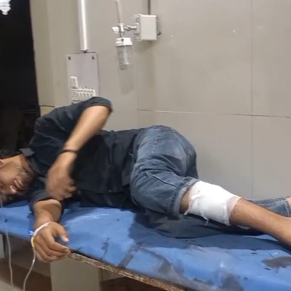 फिरोजाबाद में मुठभेड़, 25 हजार के दो इनामी लुटेरे गिरफ्तार:पैर में गोली लगने से घायल, फाइनेंस कर्मी भी साजिश में शामिल