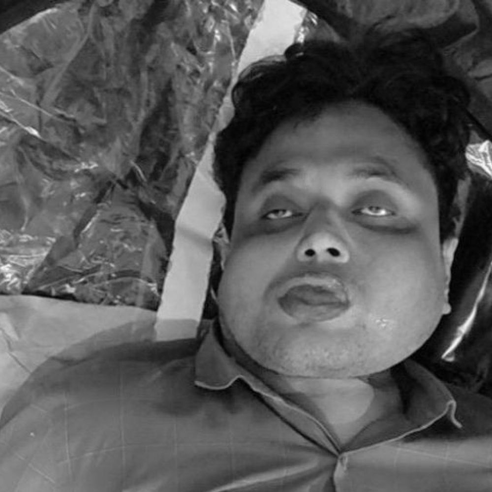 लखनऊ के होटल में युवक की संदिग्ध मौत:मुंह से निकल रहा था झाग, नोएडा से दोस्तों के साथ घूमने आया था