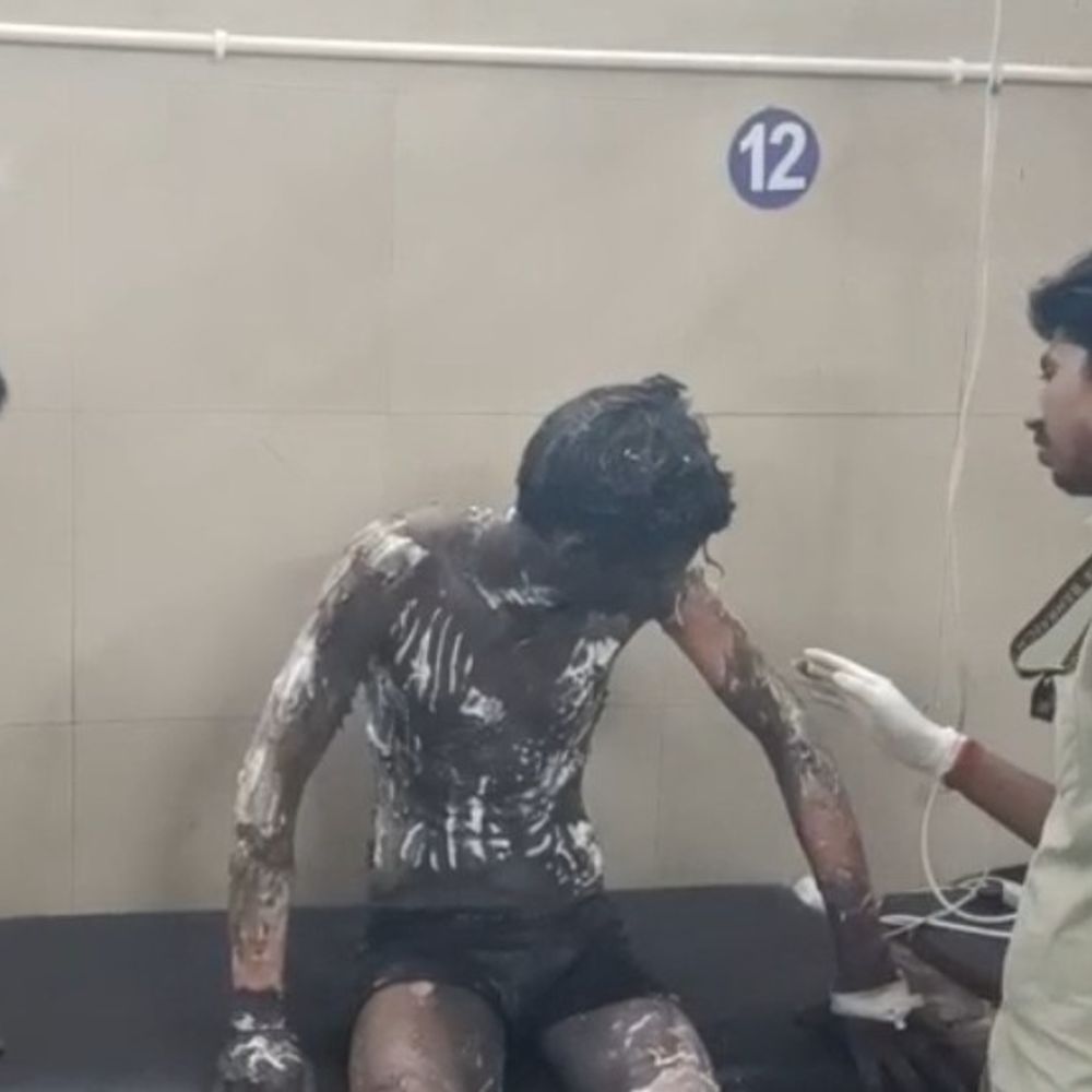 युवक पर पेट्रोल डालकर जिंदा जलाने का प्रयास:बहराइच में प्रेम प्रसंग में युवती के रिश्तेदारों ने किया हमला, हालत गंभीर