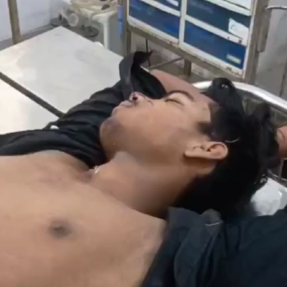 देवरिया में सड़क हादसे में युवक की मौत:फूफी को मिठाई देने जा रहा था, पिकअप ने मारी टक्कर, दोस्त गंभीर घायल