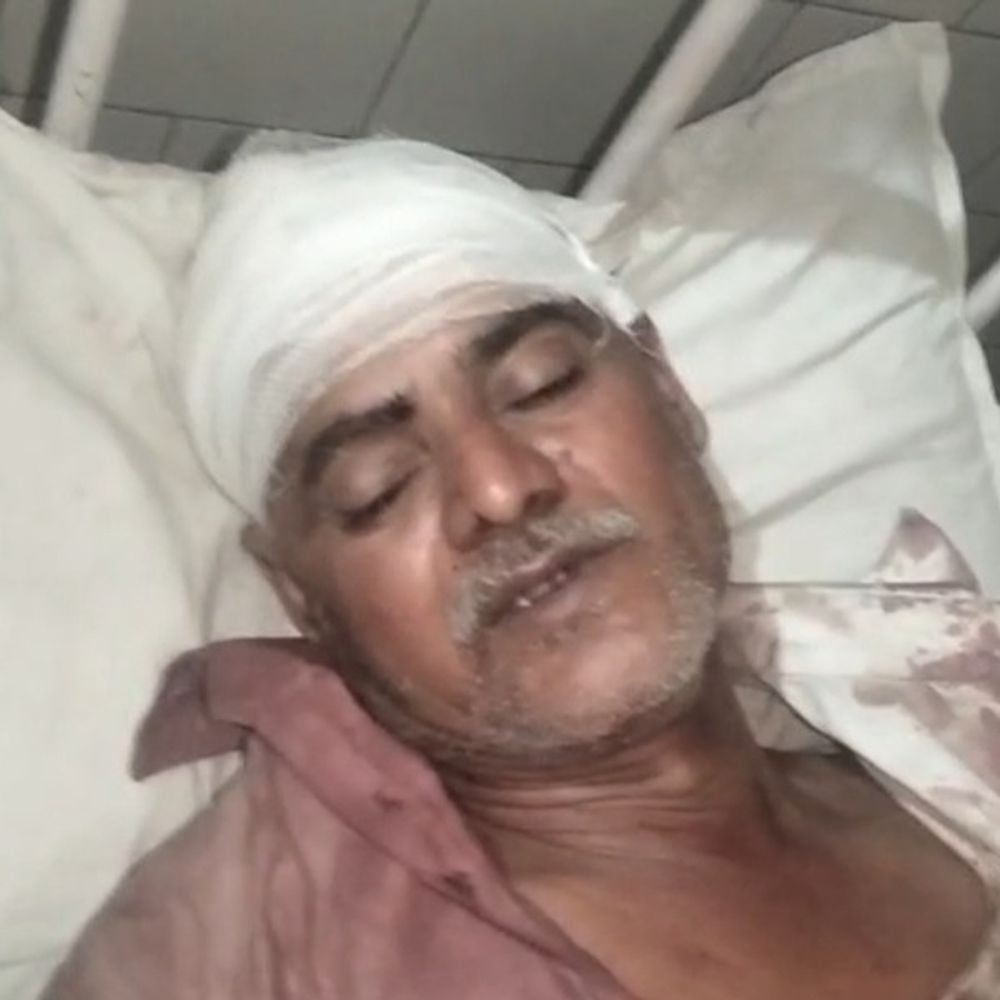 मामूली बात पर विवाद, किसान पर खौलता तेल फेंका:बदायूं में पूड़ी बनाने के लिए बैठा, चार आरोपियों पर केस दर्ज