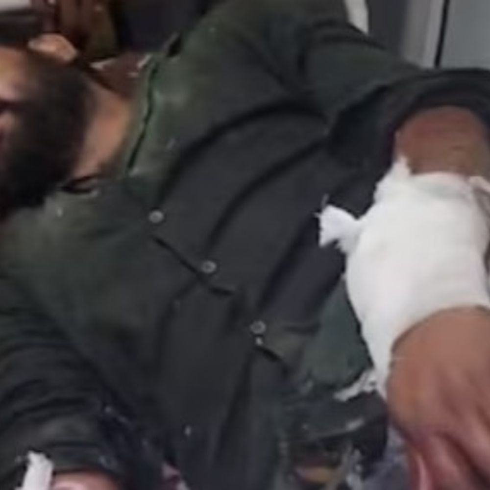 दिल्ली में मिक्सर-ग्राइंडर से हलवाई के हाथ काटने की कोशिश:शादी के बकाया पैसे मांगने पर विवाद; छत पर बांधकर पीटा; दो नाबालिग भी गिरफ्तार