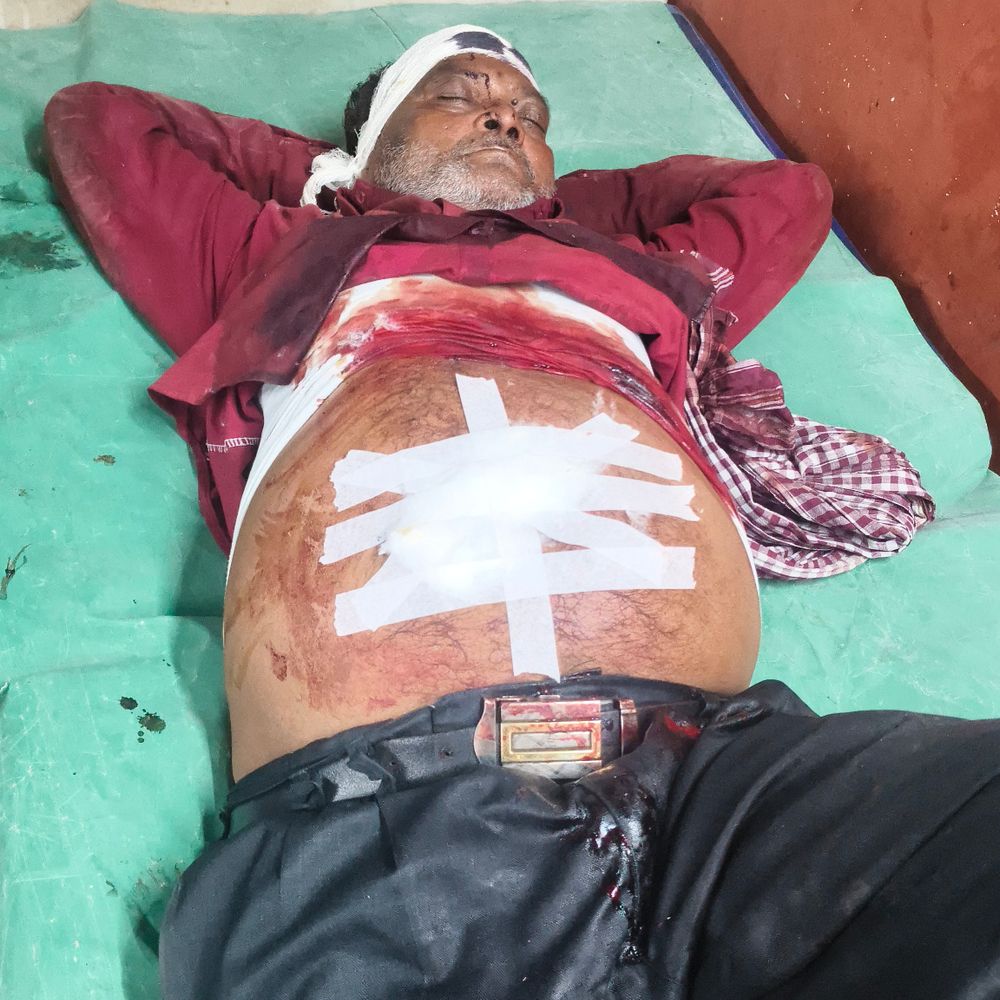 दोस्त ने चाकू मारकर मैकेनिक को किया घायल:शराब पीने के दौरान पानी लाने को लेकर दोस्त से हुआ विवाद