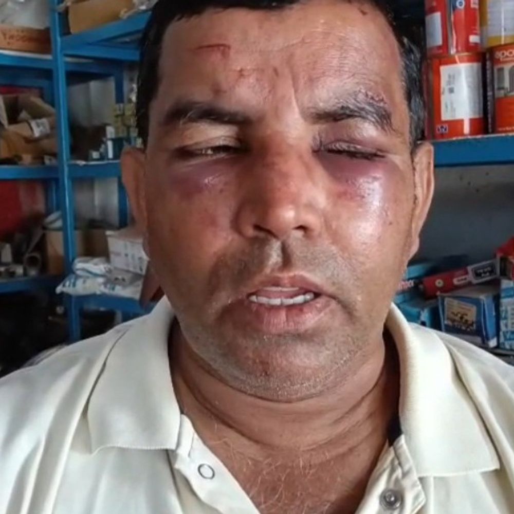 चहनियां में दुकान में घुसकर व्यापारी की पिटाई:सामान की तोड़फोड़; जान से मारने की धमकी, 2 पर केस