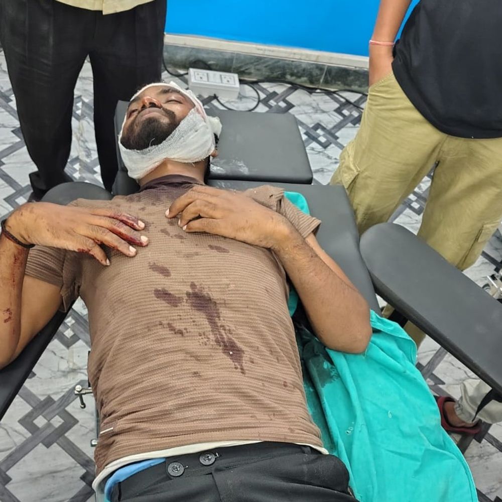 कानपुर में दबंगों ने ऑटो चालक को पीटा:महिला को होटल छोड़ने से किया मना, पत्थर मारकर फोड़ा सिर