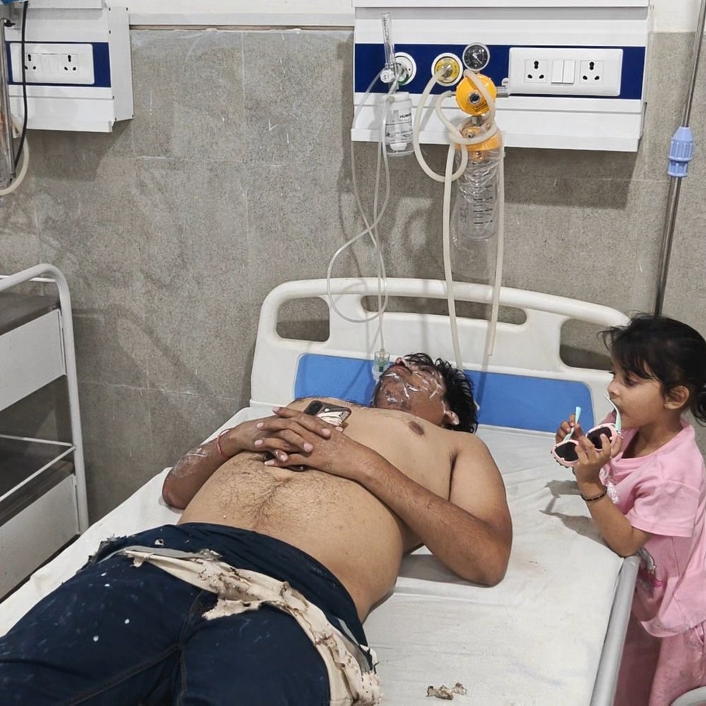 पीलीभीत में पत्नी ने पति पर किया एसिड अटैक:अवैध संबंध का विरोध करने पर किया हमला, खुद भी हुई घायल