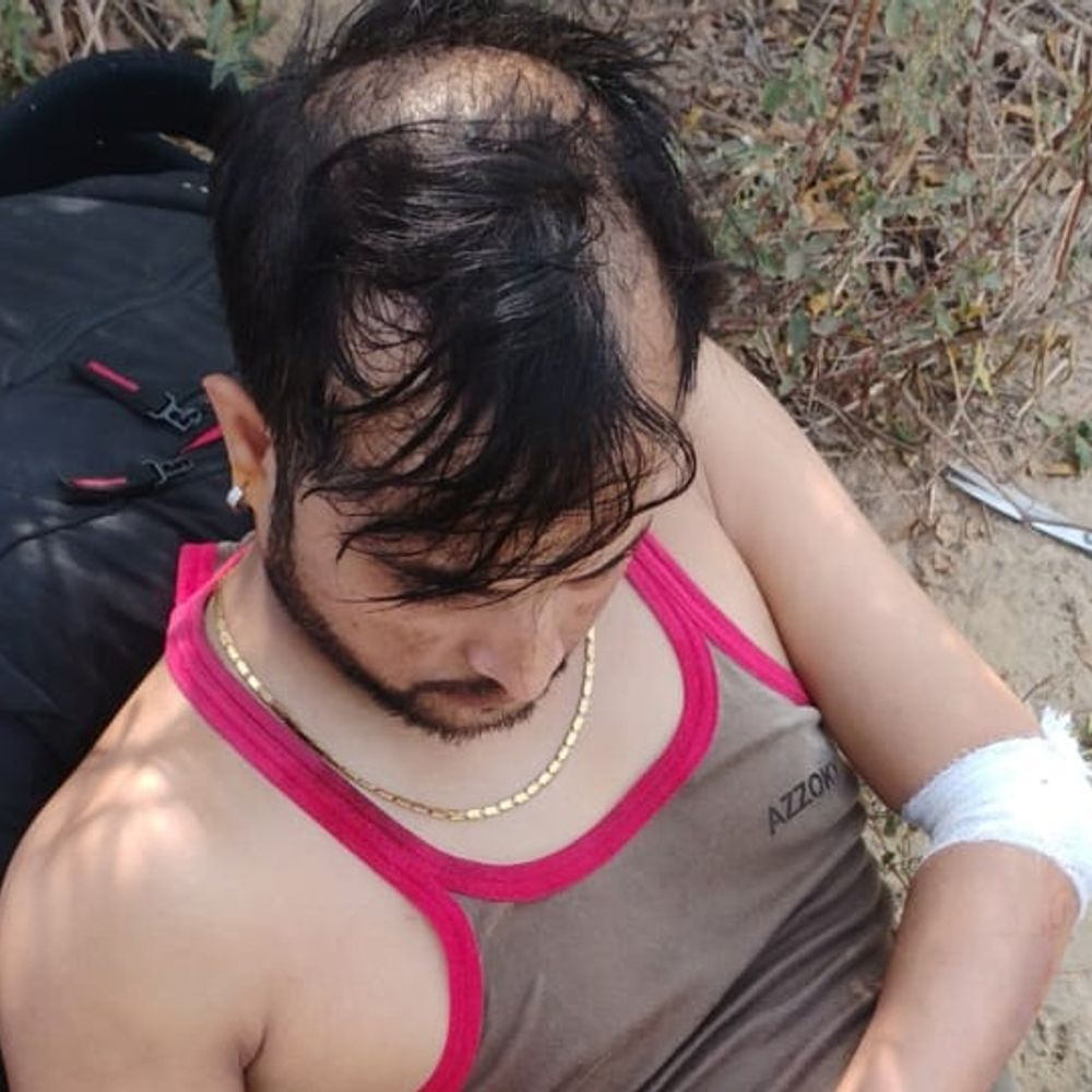 यमुना एक्सप्रेसवे पर बाइक हादसा:मथुरा में एक युवक गंभीर घायल, अस्पताल में भर्ती