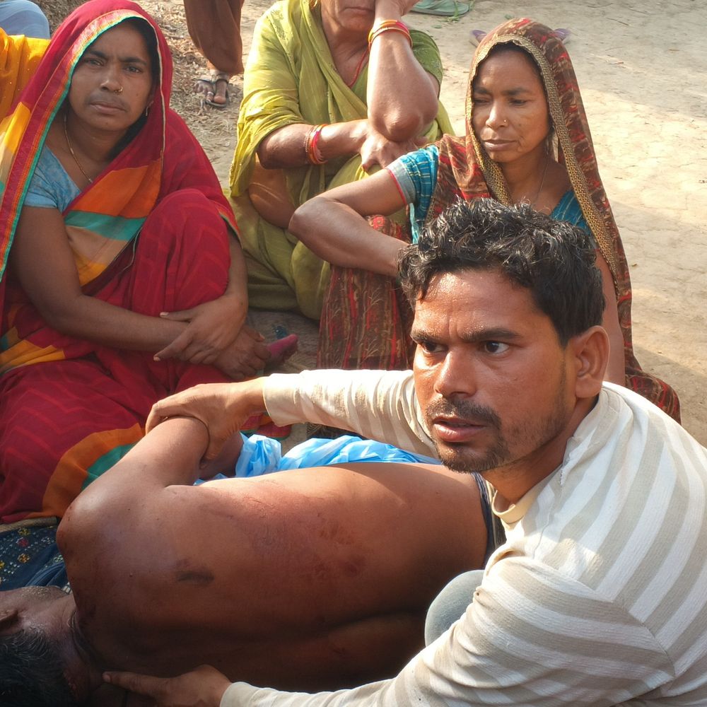 सोनभद्र में बारात से लौटे युवक की संदिग्ध मौत:गर्दन पर चोट के निशान, परिजनों ने हत्या का लगाया आरोप