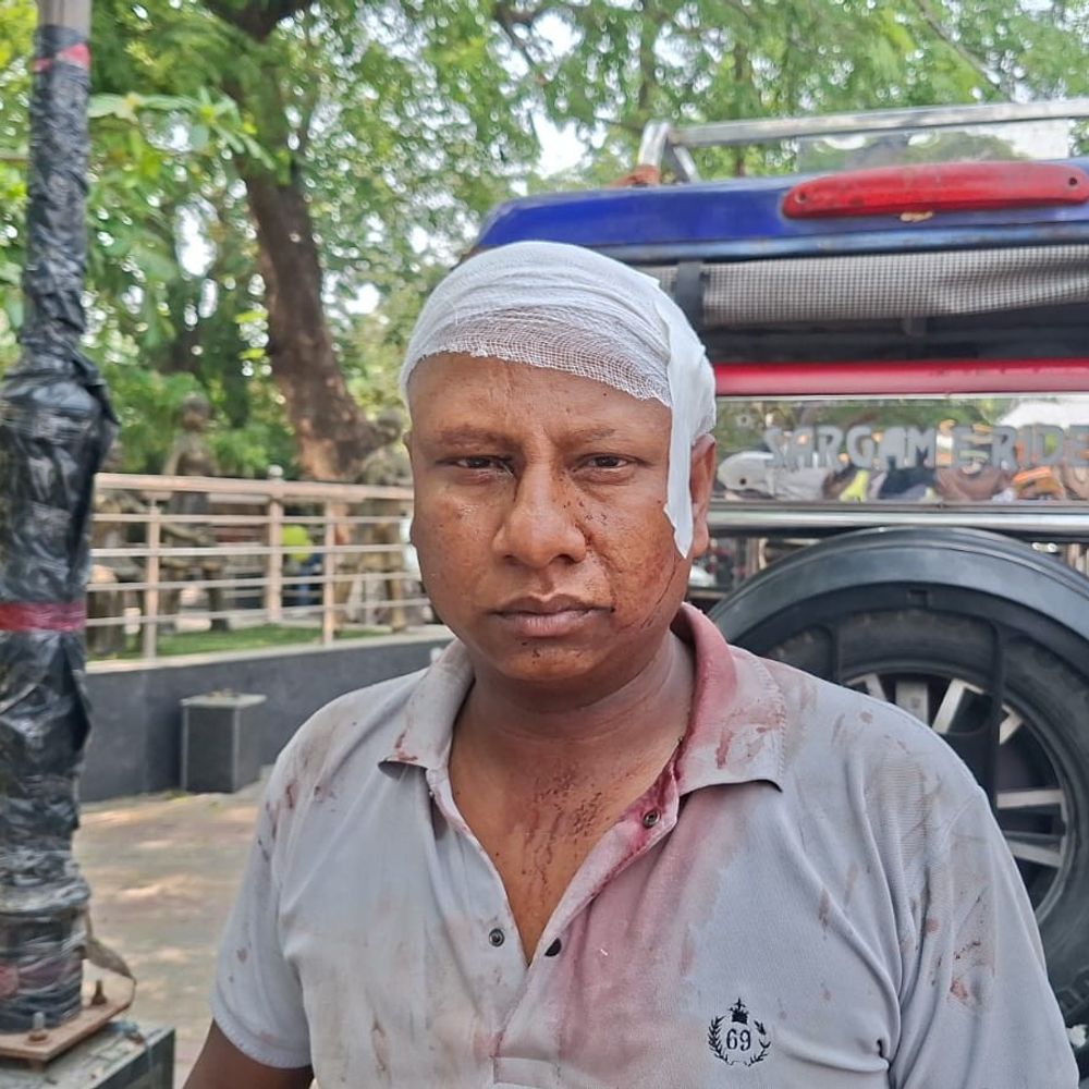 मिनी मेट्रो चालक को ईंट से मारकर लहूलुहान किया:मुरादाबाद में नशेड़ी युवक को बैठाने से मना करने पर हुआ हमला, अस्पताल में भर्ती