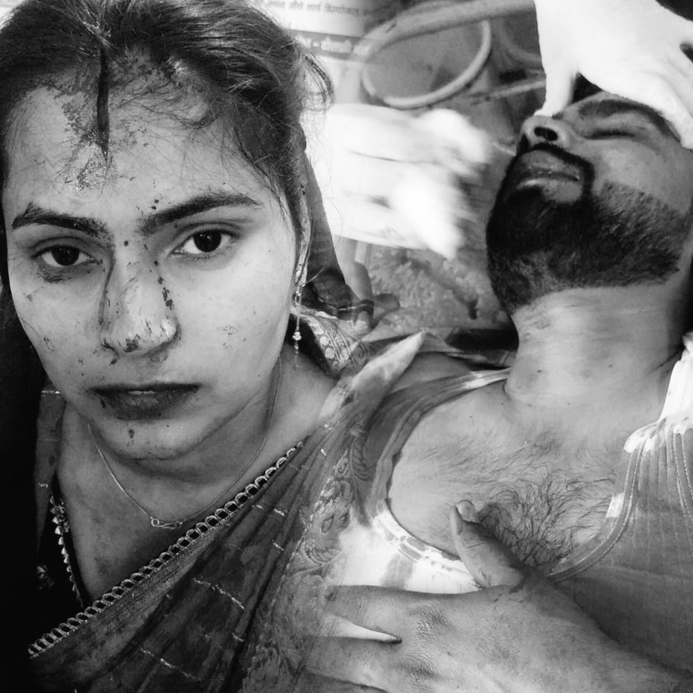 जानवर से टकराई बाइक, 2 साल के बच्चे की मौत:इटावा में दंपती गंभीर घायल, सैफई मेडिकल यूनिवर्सिटी रेफर