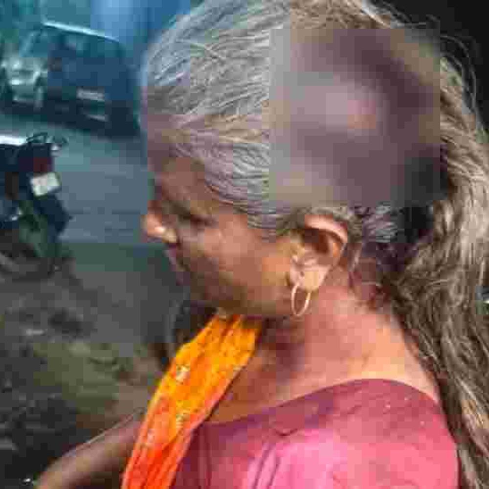 छेड़छाड़ केस में सुलह न करने पर सास-बहू पर हमला:आरोपी ने घर में घुसकर सिर फोड़ा, लाठी से किया हमला