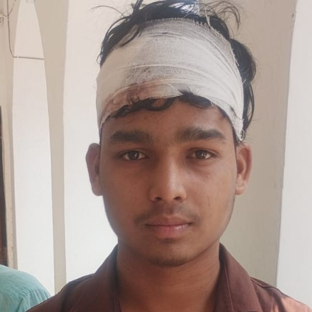 संतकबीर नगर में डीजे बंद कराने को लेकर मारपीट:आधा दर्जन बाराती घायल, एक का सिर फटा; केस दर्ज