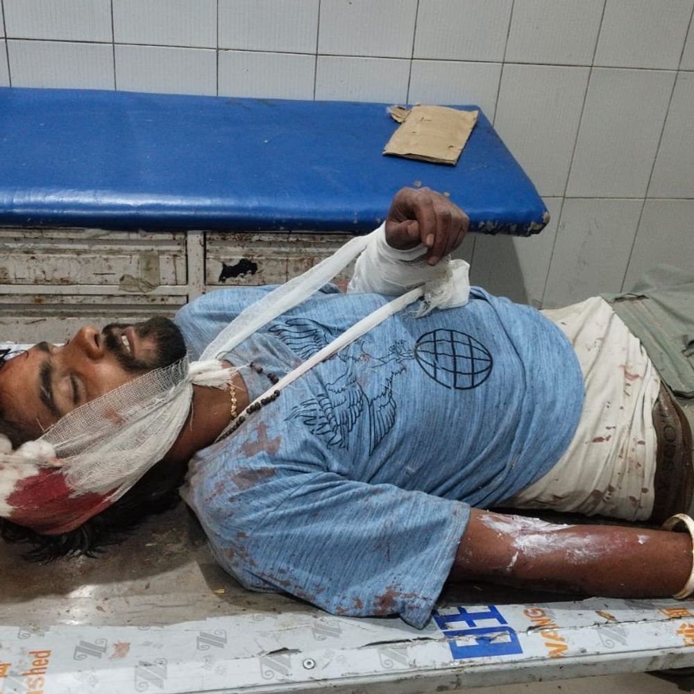 तेज आंधी में सरकारी होर्डिंग गिरी, चार घायल:कार और बाइक भी चपेट में आईं, एक को रायबरेली एम्स रेफर किया गया