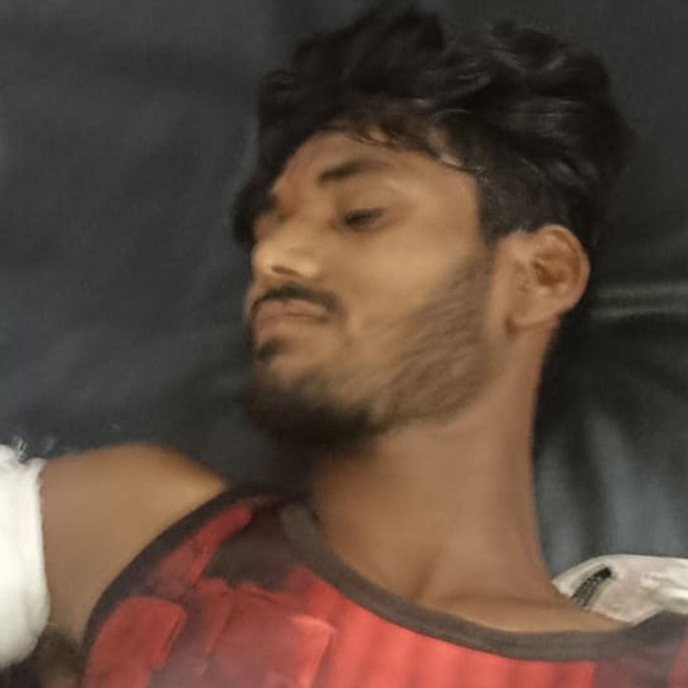 सीधी में बस-पिकअप में टक्कर, युवक का हाथ कटकर अलग:  रीवा रेफर; चश्मदीद बोले- बस ड्राइवर नशे में था, वाहन छोड़कर भागा – Sidhi News