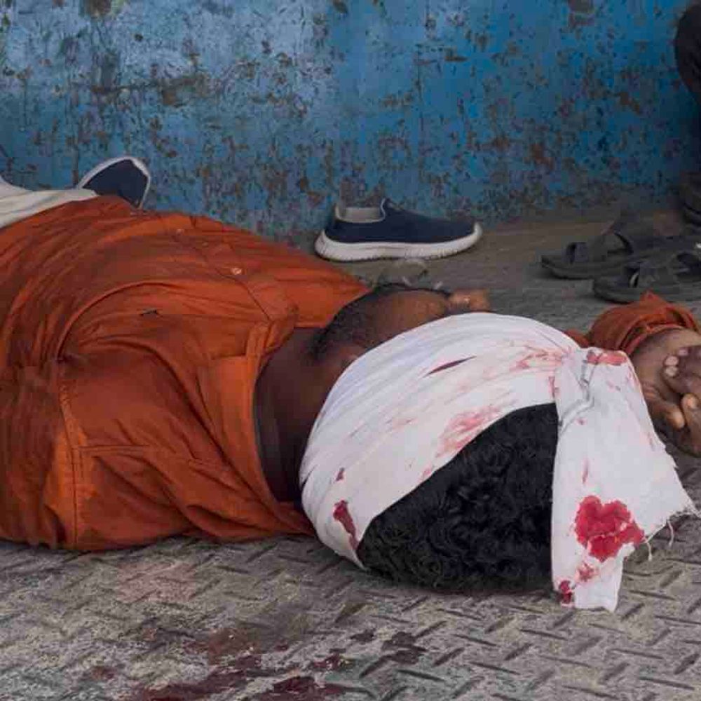 ब्रेक फेल होने से पिकअप डंपर से टकराई:कानपुर में हुए हादसे में तीन लोग घायल, एक की हालत गंभीर