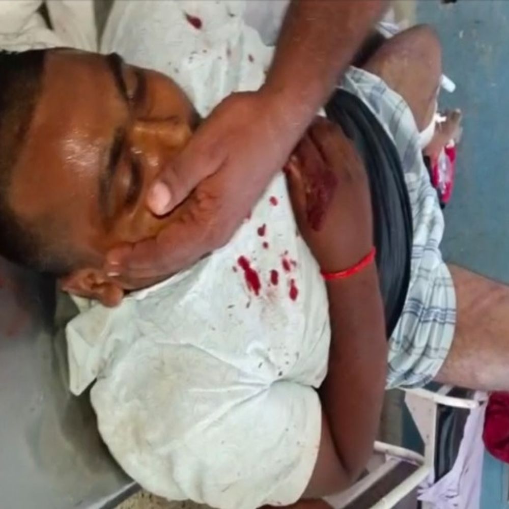 सुल्तानपुर में युवक की पीट-पीटकर हत्या:भ्रष्टाचार की शिकायत से बढ़ी थी रंजिश, पुलिस की 2 टीमें जांच में लगी, हिरासत में आरोपी