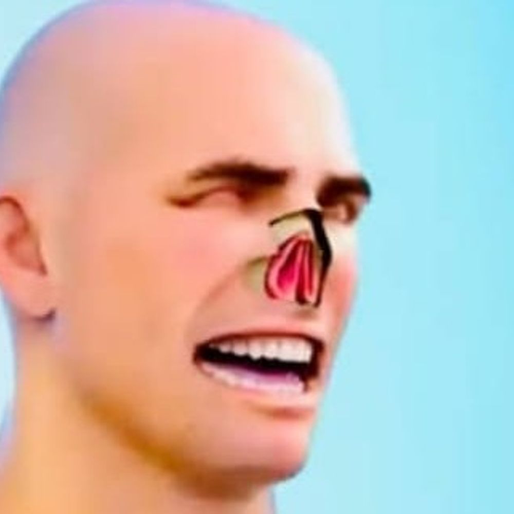 आगरा में जूता कारीगर की नाक काटी:धारदार हथियार से किया हमला, सिर में 12 और हाथों में 40 टांके आए