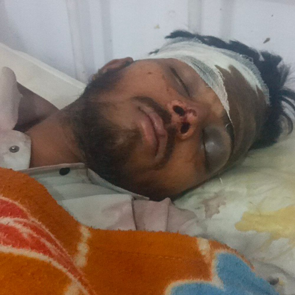 वॉलीबॉल विवाद में युवक पर रॉड से हमला:दो युवकों ने मुकेश को पीटा, वीडियो वायरल होने पर पुलिस जांच में जुटी