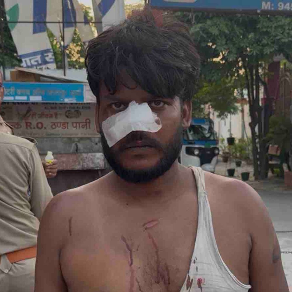 भतीजे की स्मैक पकड़वाने पर चाचा की पिटाई:कट्टे की बट और लाठी-डंडों से पीटकर किया लहूलुहान