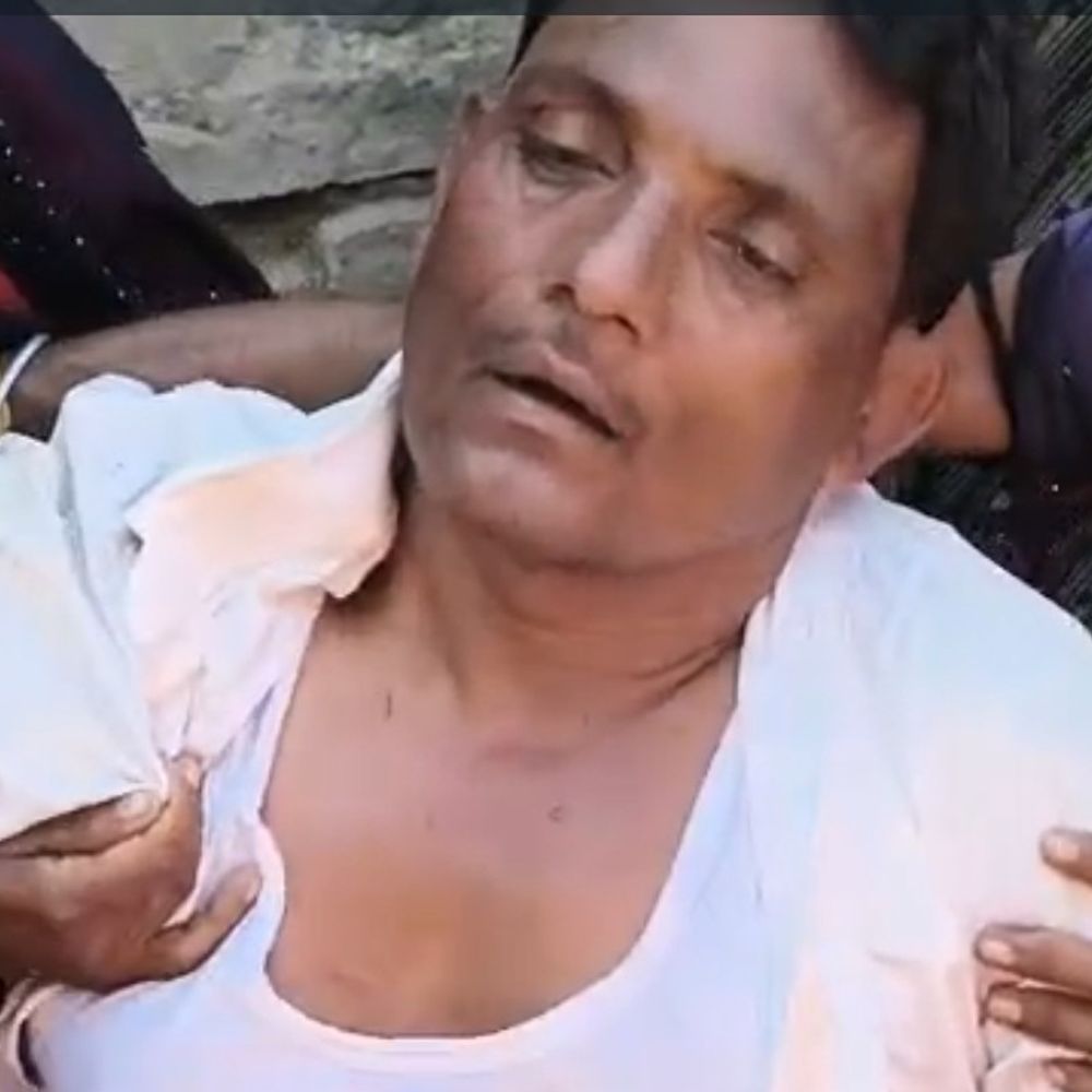 श्योपुर में जनगणना कार्य के दौरान कोटवार पर हमला:  6 हमलावरों ने लाठी-डंडों, कुल्हाड़ी से पीटा, सभी फरार – Sheopur News