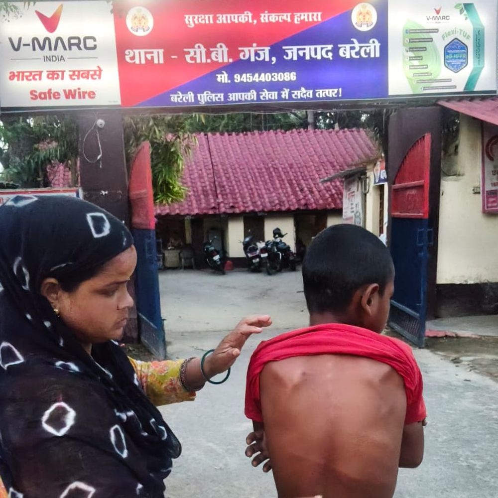 बाग से आम तोड़ने पर 3 बच्चों को बनाया बंधक:तीनों को बेल्टों और लात-घूंसों से पीटा, आरोपियों की तलाश में पुलिस दे रही दबिश