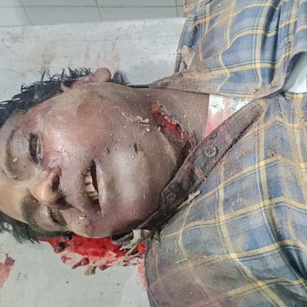 अंबेडकरनगर में कार ने लोगों को रौंदा, 8 की मौत:दो बाइक की टक्कर में घायलों को बचा रहे थे लोग, तभी कार ने मारी टक्कर