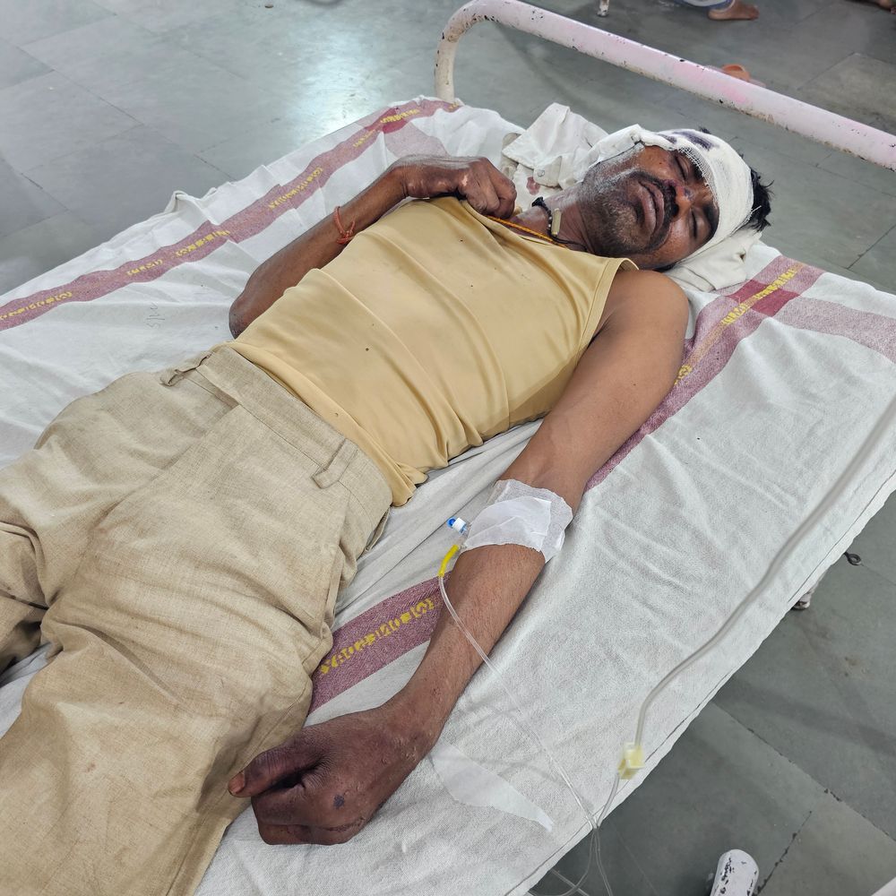 बस के सामने आने से बाइक अनियंत्रित, दो घायल:एक की हालत गंभीर, मुंडन से लौटने के दौरान मंदसौर-सीतामऊ रोड पर हादसा