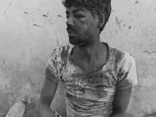 करनाल में 2 हजार के लिए युवक पर जानलेवा हमला:  मुंह में आर-पार घोंपा चाकू, टांगों पर भी किए वार; मोबाइल भी छीनकर ले गए हमलावर – Karnal News