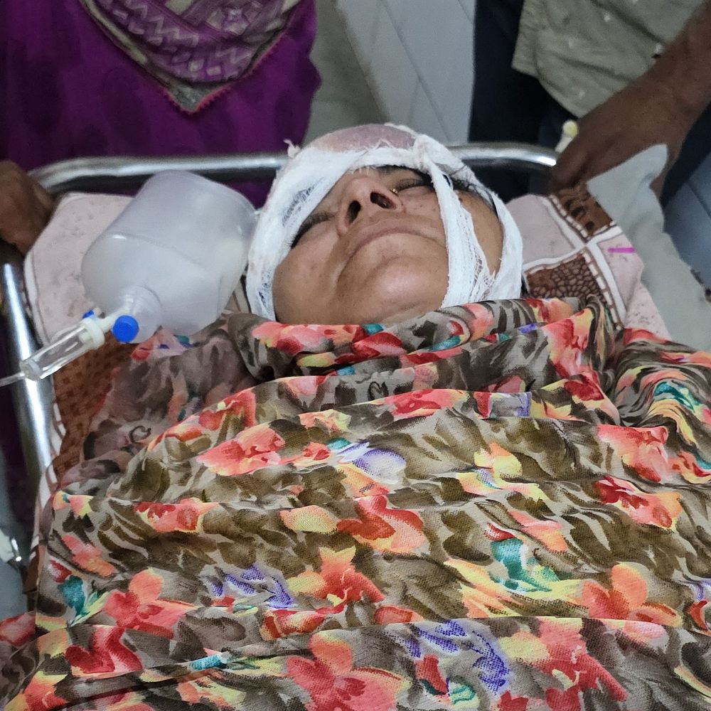 औरंगाबाद में 2 पक्षों में मारपीट,दंपती समेत तीन लोग घायल:  घायल बोला- पड़ोसियों ने आंखों में मिर्च पाउडर डाला, फिर लोहे के रॉड से किया हमला – Aurangabad (Bihar) News