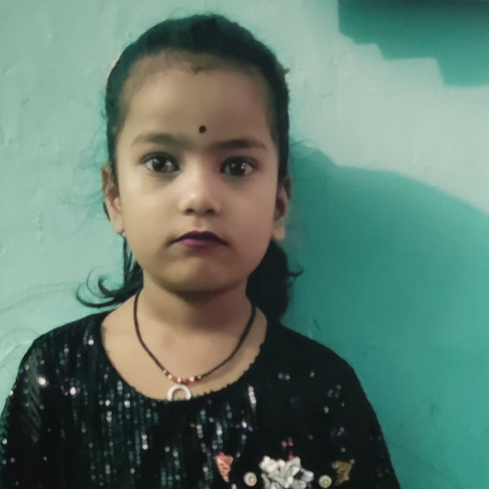 मऊ जिला अस्पताल में बच्ची की मौत:परिजनों ने लगाया इलाज में लापरवाही का आरोप, गर्म दूध से जल गई थी