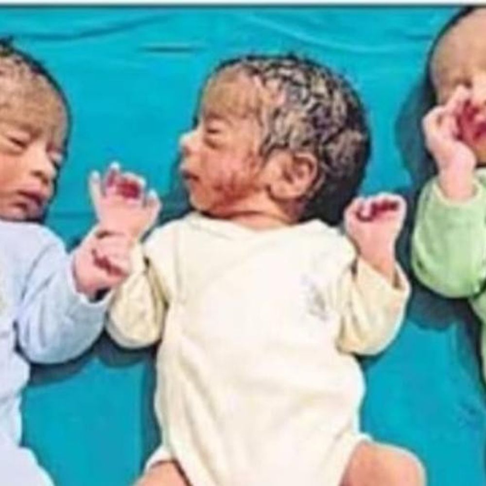 महिला ने एक साथ तीन बच्चों को दिया जन्म:खलीलाबाद में सफल जटिल सिजेरियन; जच्चा और बच्चा स्वस्थ