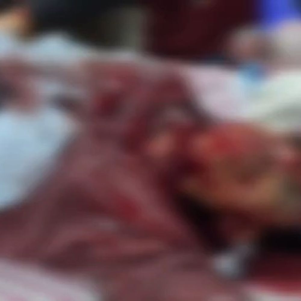 एक्सप्रेस-वे पर तेज रफ्तार वाहन की टक्कर से युवक घायल:बागपत के काठा टोल प्लाजा के पास हुआ हादसा, पुलिस जांच में जुटी