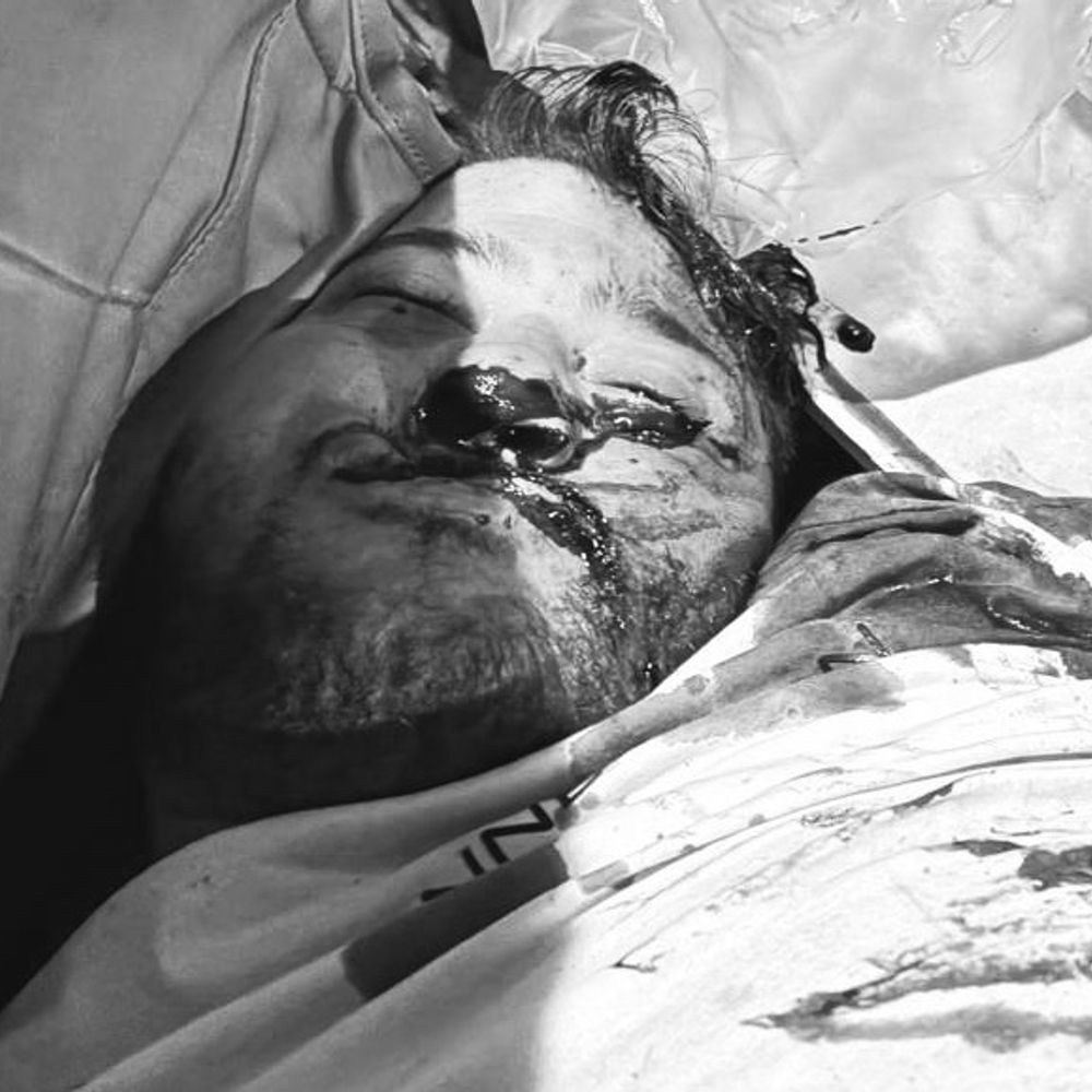 लुधियाना में बीच सड़क खड़े कंटेनर से टकराई बाइक:  लापरवाही ने ली जान ,तीन बहनों के इकलौते भाई की  मौत मामला दर्ज – Ludhiana News