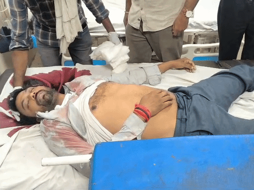 BREAKINGफीलखाना में होजरी दुकानदार का मर्डर:  सवई सिंह का हाता में लहुलूहान पड़ा मिला, सिर से निकल रहा था खून – Kanpur News