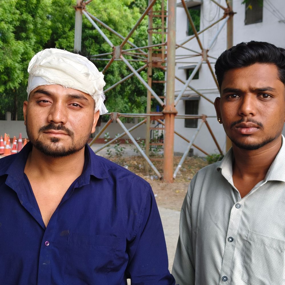 12 टांके लगे, पुलिस ने केस में हल्की धाराएं लगाईं:  पीड़ित ने एएसपी से शिकायत की, बोला- एससी-एसटी एक्ट लगाया जाए – Narsinghpur News