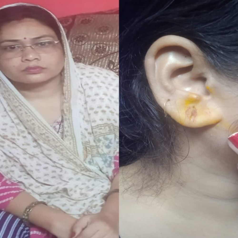 ग्वालियर में हाईवे से दंपती से गहने लूटे:  शादी में जा रहे थे, बदमाशों ने पति पर अड़ाया कट्‌टा, पत्नी से लूटा मंगलसूत्र-झुमके – Gwalior News