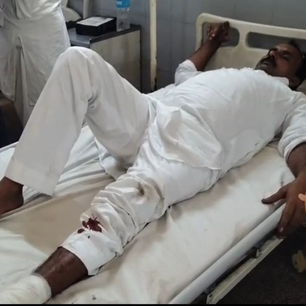 बुलंदशहर कचहरी में वकीलों के दो गुटों में फायरिंग:दो अधिवक्ता गोली लगने से घायल, चेंबर विवाद को लेकर मारपीट