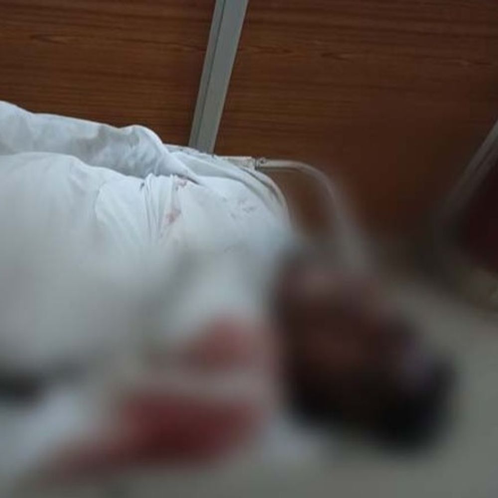 तेज रफ्तार कार पेड़ से टकराई, 1 की मौत:  4 लोग गंभीर रूप से घायल, अंबिकापुर रोड से लौटते समय हुआ हादसा – Raigarh News
