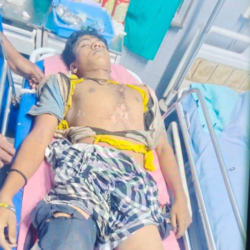 दुर्ग में बिजली गिरने से 12वीं के छात्र की मौत:दोस्तों के साथ मैदान में क्रिकेट खेल रहा था,बारिश होने पर भागते समय गिरी बिजली