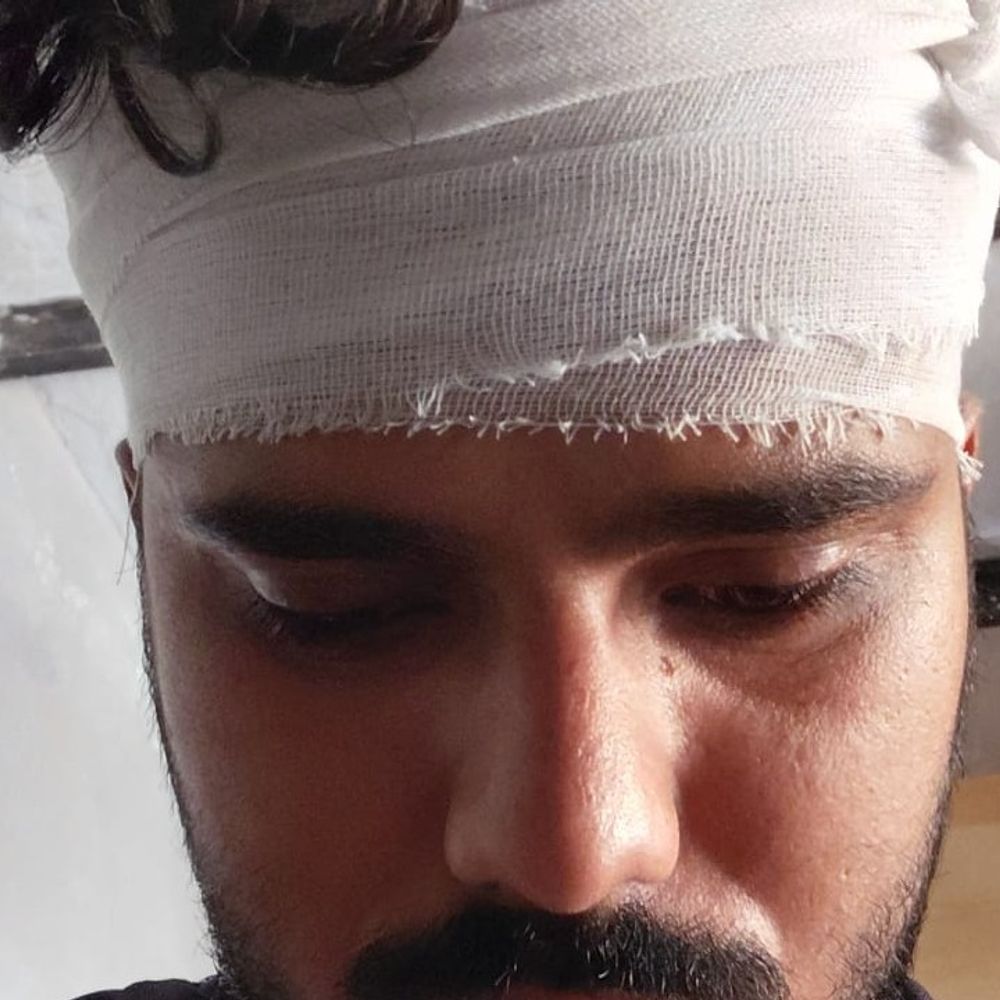 सिरसा JCD के छात्र पर रंजिशन हमला, सिर फोड़ा:  आरोप-बस स्टैंड के पास सरेआम पीटा, 6 माह पहले हुआ था झगड़ा – Sirsa News