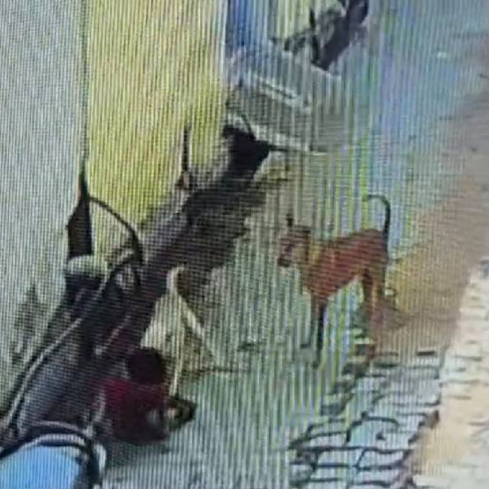 कुत्तों ने 2 साल के बच्चे पर किया अटैक:झांसी में घर के बाहर खेल रहा था मासूम, दौड़ते हुए आए, फिर पटककर नौंचा