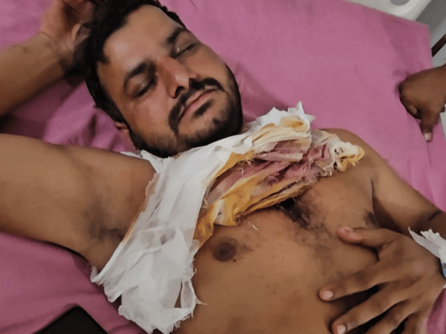 भरतपुर में बदमाशों ने दुकान पर की ताबड़तोड़ फायरिंग:दो लोगों को लगी गोली, खेत से लौट रहे युवक के सीने में घुसी