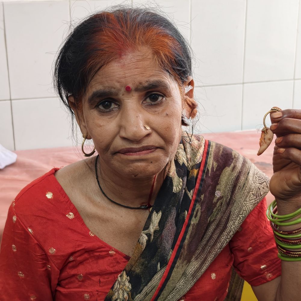 एटा में रास्ता विवाद में महिला का काटा कान:दो पक्षों के मारपीट में पांच लोग घायल, पुलिस जांच में जुटी