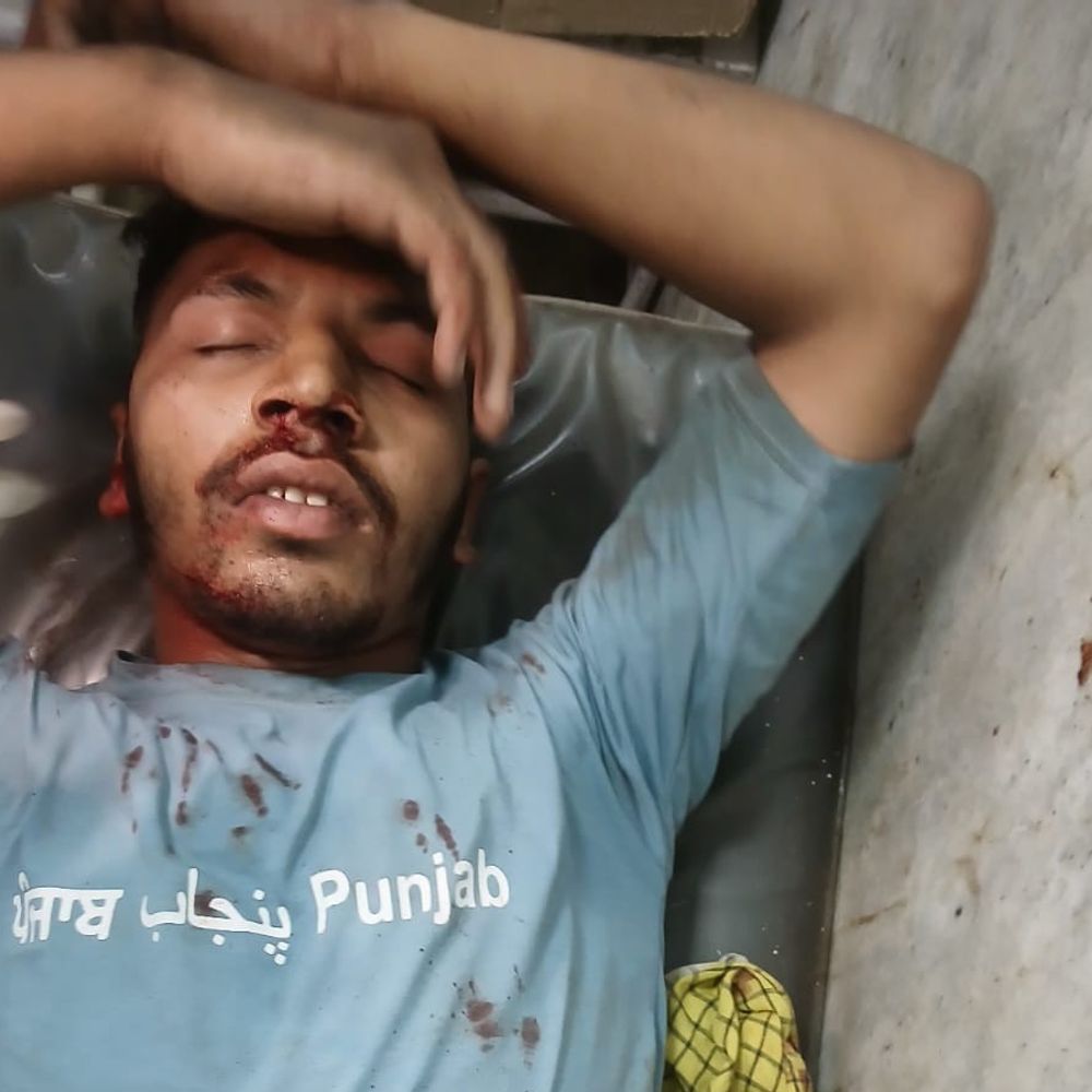 मोगा में स्कूटी ने पैदल यात्री को मारी टक्कर:  दोनों घायल, हादसे का सीसीटीवी वीडियो सोशल मीडिया पर वायरल – Moga News
