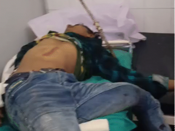 बांसवाड़ा में निर्माणाधीन पुलिया में घुसी बाइक, दो की मौत:एक युवक के हाथ को चीर कर पैर में घुसा लोहे का सरिया, दूसरे का सिर फटा