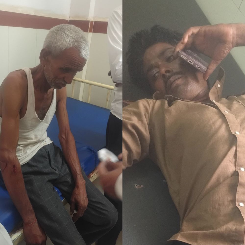 कुएं से बाहर निकलते ही तेंदुए का हमला:  शिवपुरी में रेस्क्यू के दौरान मची अफरा-तफरी; 2 ग्रामीण घायल – Shivpuri News